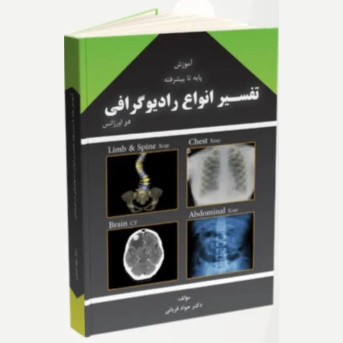 تفسیر انواع رادیو گرافی
